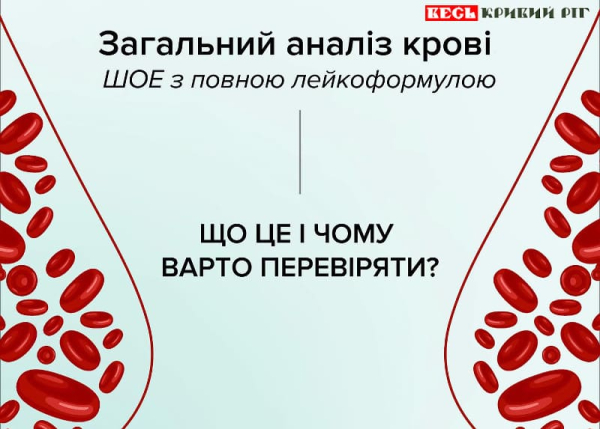 Навіщо робити ЗАК – загальний аналіз крові