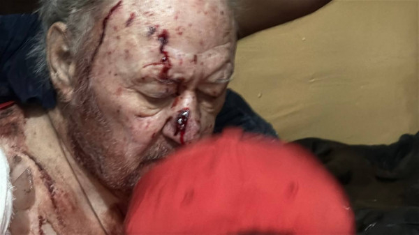 Вночі ворог атакував з повітря Одесу, бив по пологовому будинку і житловому сектору, є загибла людина і постраждалі4