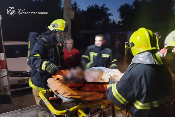 У Кривому Розі внаслідок пожежі ледве не загинула людина0