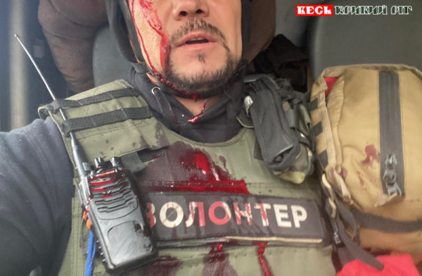 Криворізький волонтер Олег Леонтьєв зазнав осколкових поранень у Костянтинівці