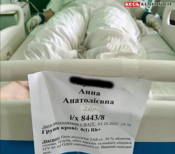 Працівниця АЗС отримала важкі опіки на Зарічному в Кривому Розі
