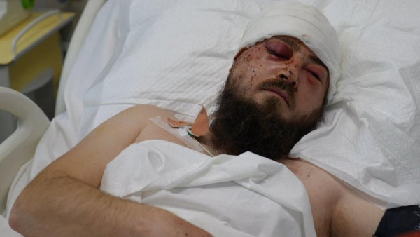 Нейрохірурги США та України врятували зір українському військовому після поранення дрона1