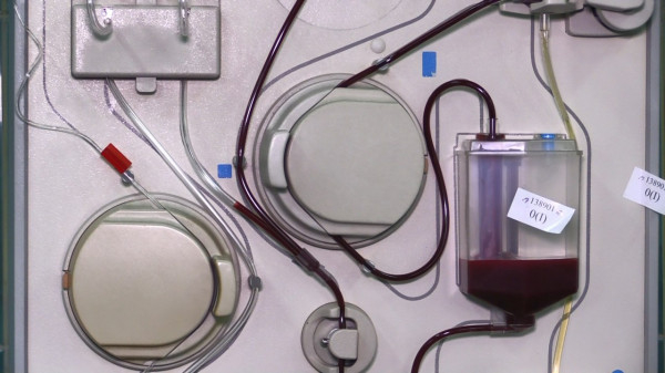 Криворізькій станції переливання крові терміново потрібна 4-та позитивна група крові0