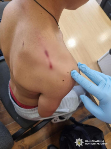 На Закарпатті дев’ятикласник вистрілив у школі з травматичного пістолета1