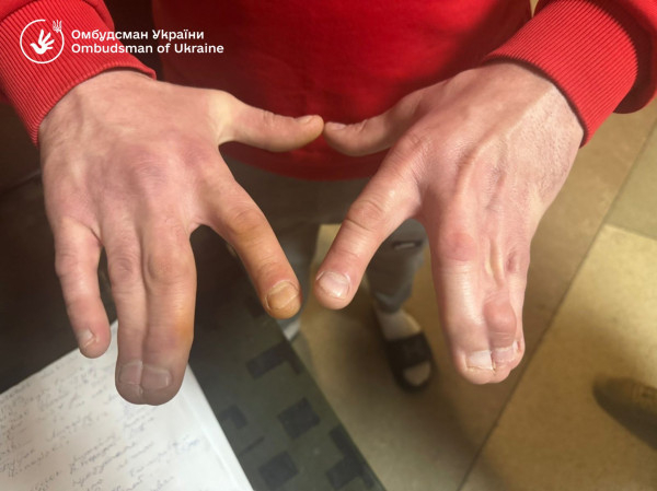 Незаконне утримання та антисанітарія: результати перевірки ТЦК на Закарпатті2