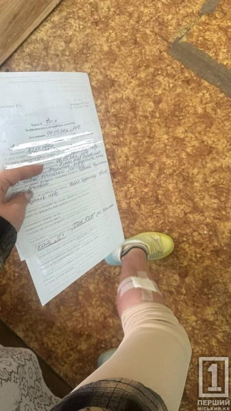 На Даманському вулична собака напала на дівчину: деталі події2