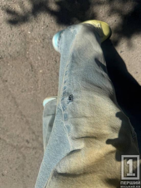 На Даманському вулична собака напала на дівчину: деталі події1