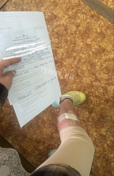У Кривому Розі на мікрорайоні Даманський безпритульний собака покусав дівчину1