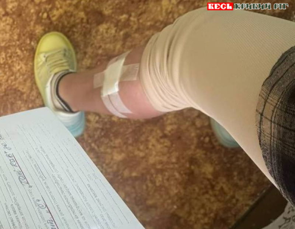 Дівчину покусала безхатня собака на Даманському в Кривому Розі